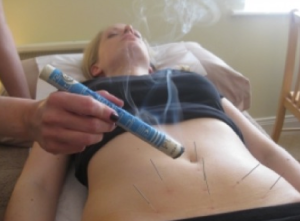 Acupuncture and mocsa over the womb